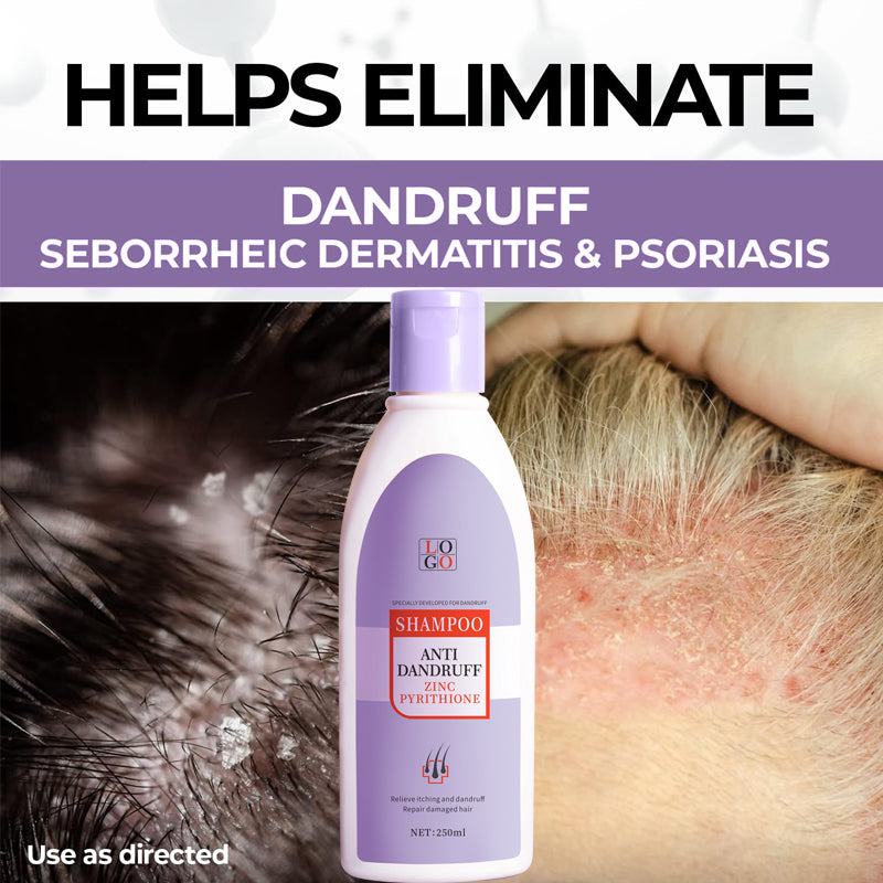 Завод по производству шампуня против перхоти с пиритионом цинка OEM