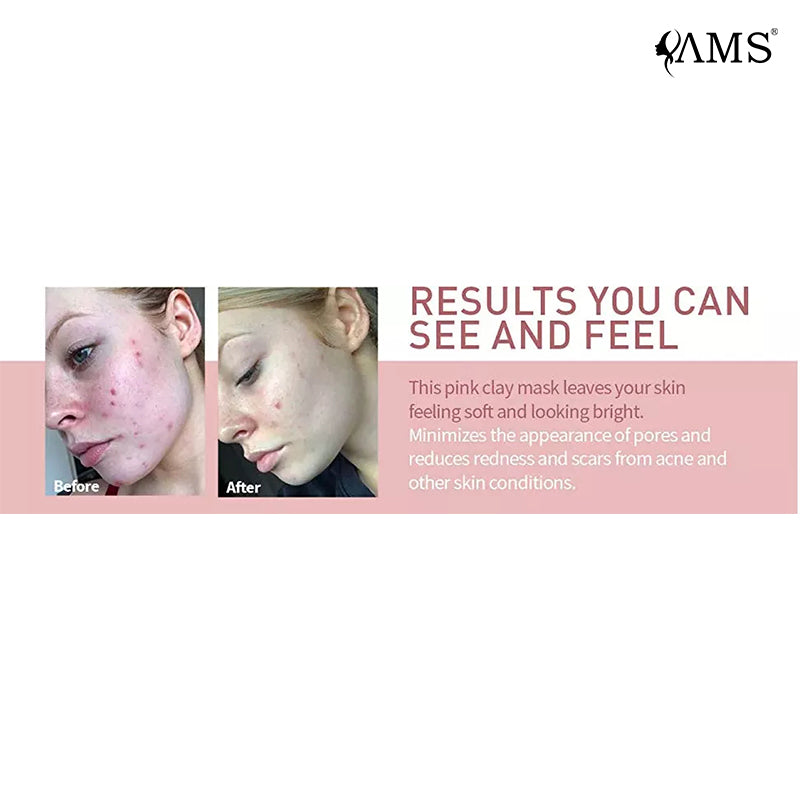 Глиняная маска Косметика OEM ODM Factory